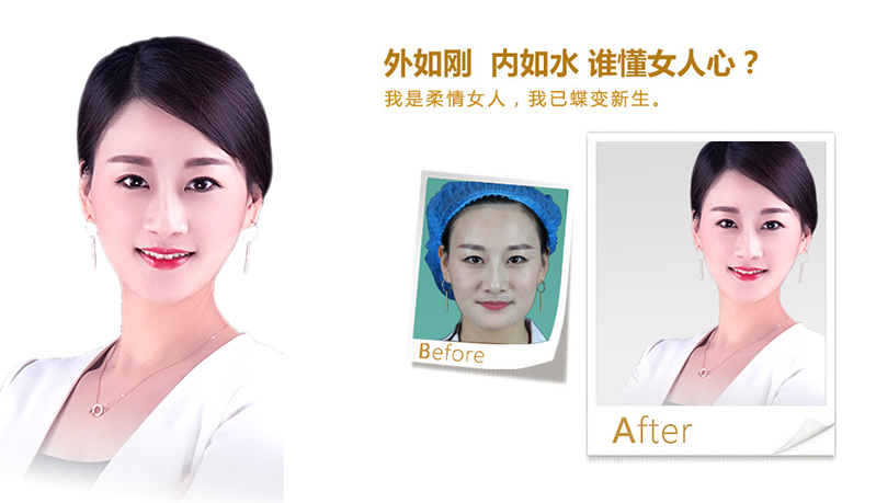 西宁V脸、线雕隆鼻